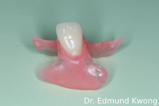 dentures sia partial denture dental teeth flexible